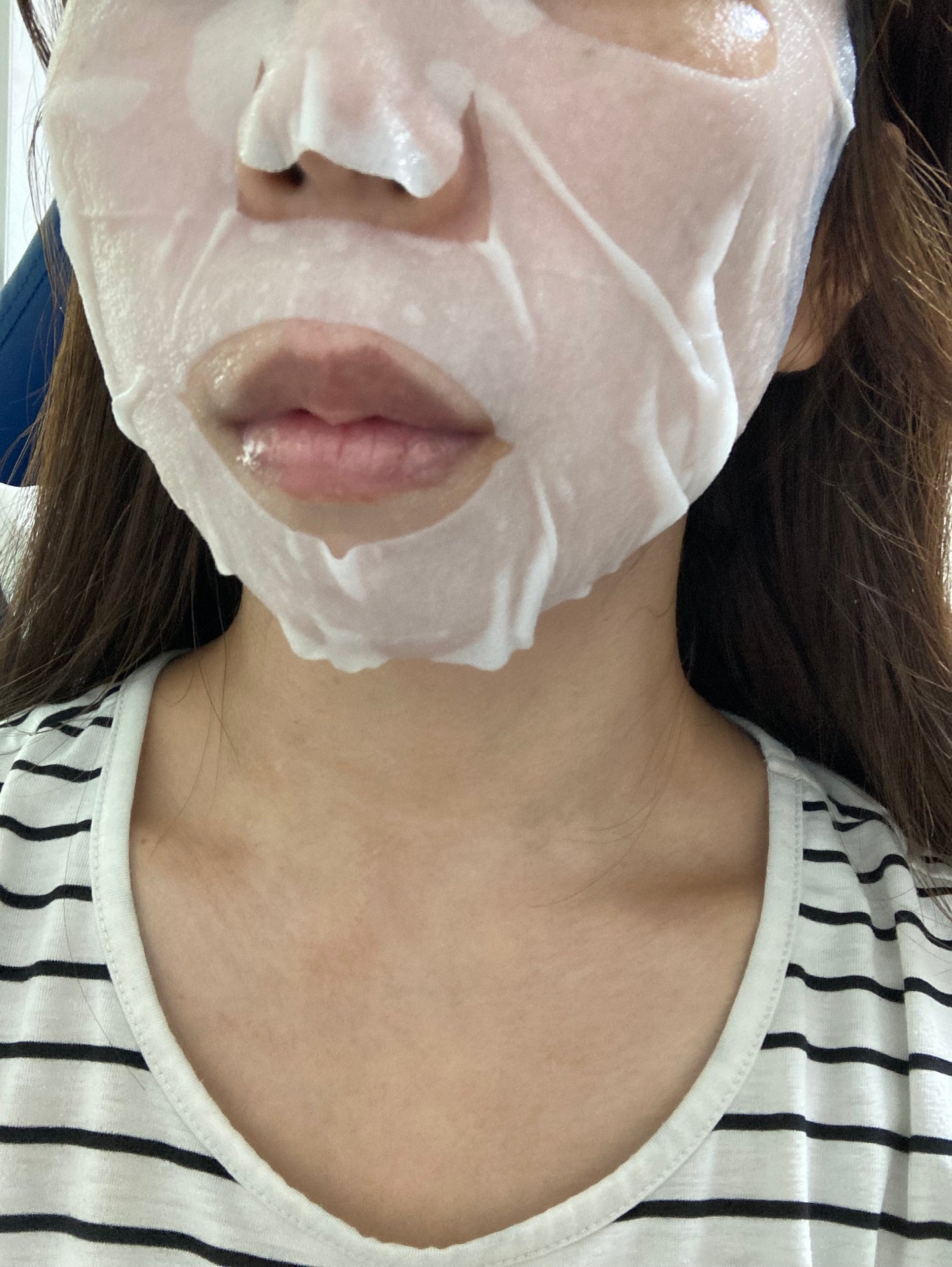 弱酸性PHシートマスク 復活草フィット/Abib /シートマスク・パックを使ったクチコミ(2枚目)