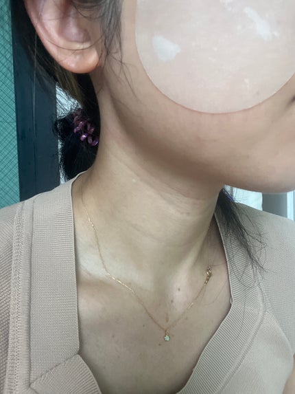 アビブ グルタチオンソームダークスポットセラムビタドロップ/Abib /美容液を使ったクチコミ(6枚目)