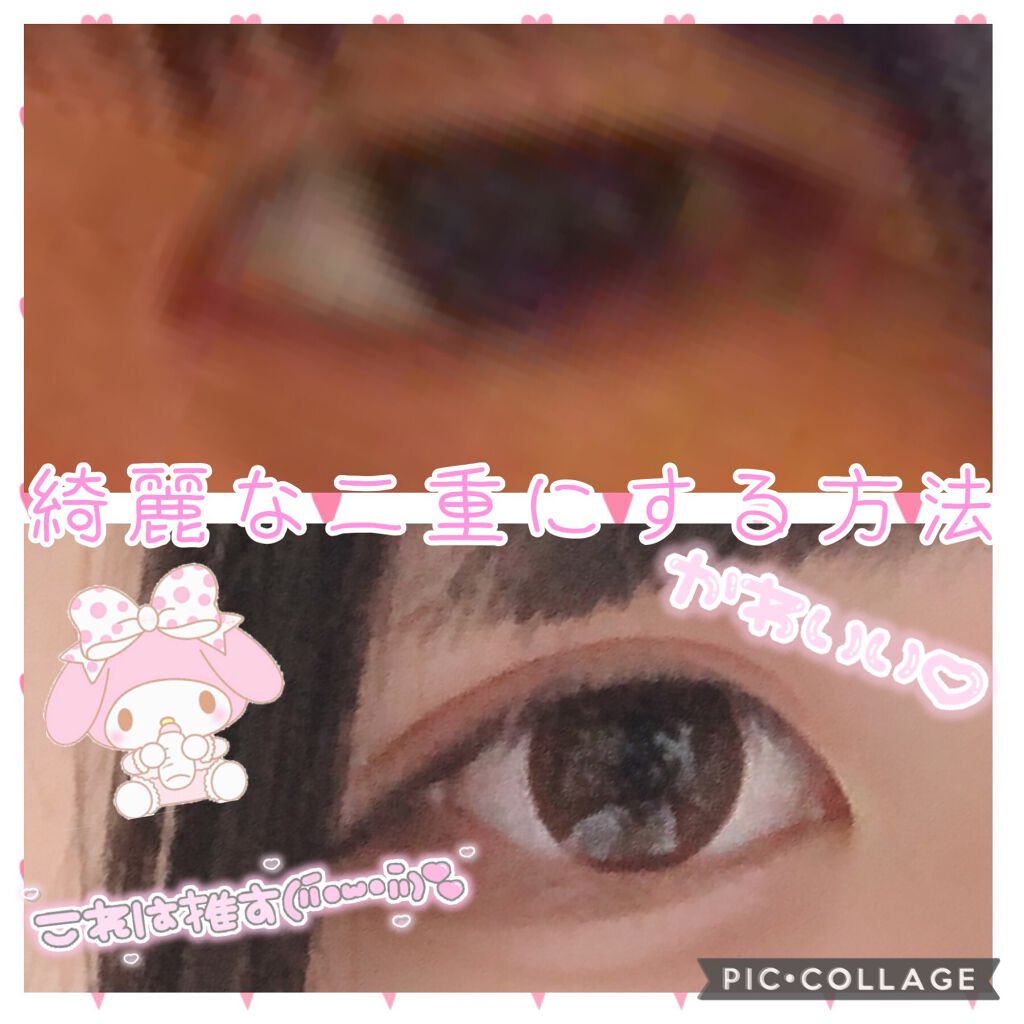 二重まぶた用シール/DAISO/二重まぶた用アイテムを使ったクチコミ（1枚目）