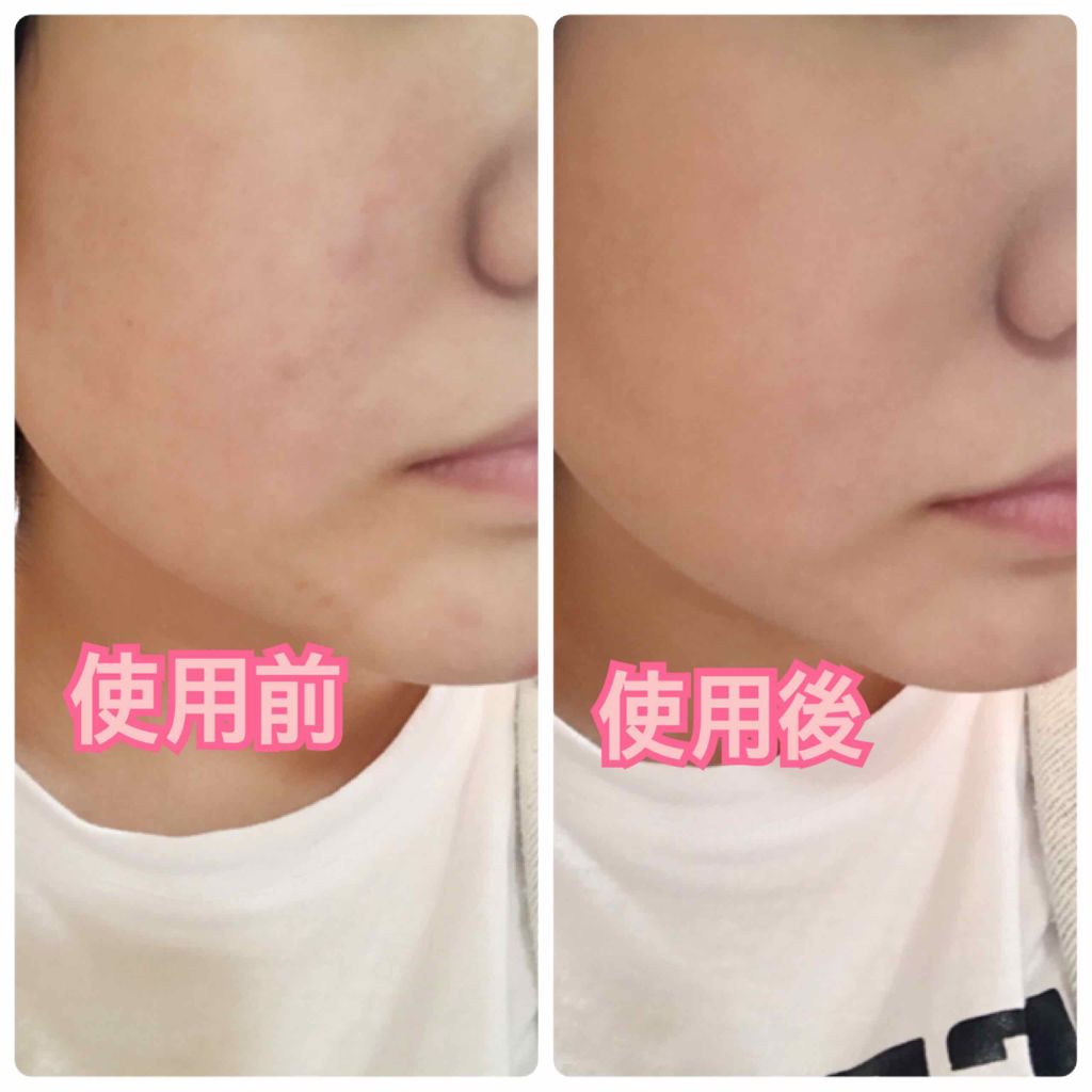 マシュマロフィニッシュファンデーション/キャンメイク/パウダーファンデーションを使ったクチコミ（2枚目）