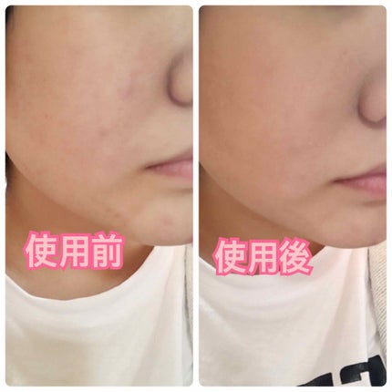 ナチュラル チークN/CEZANNE/パウダーチークを使ったクチコミ(2枚目)