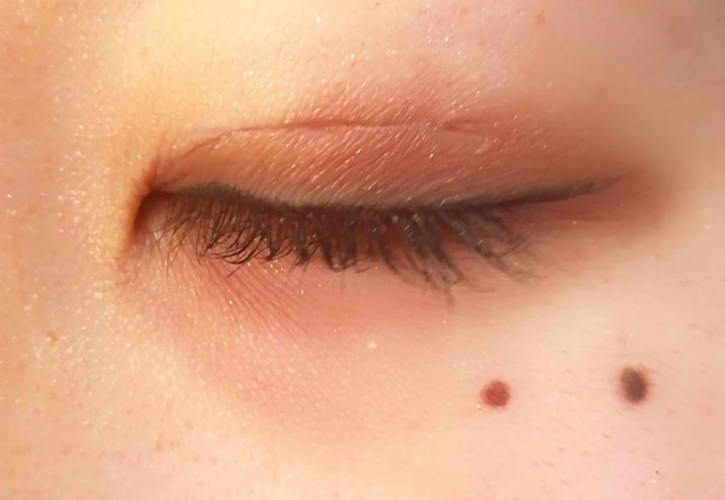 ストリングファイバー120 ディープタイプ/メザイク/二重まぶた用アイテムを使ったクチコミ（3枚目）