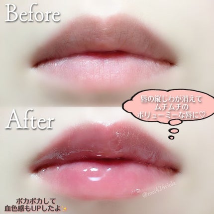 HOTOMI リッププランパー/HOTOMI/リッププランパーを使ったクチコミ(6枚目)