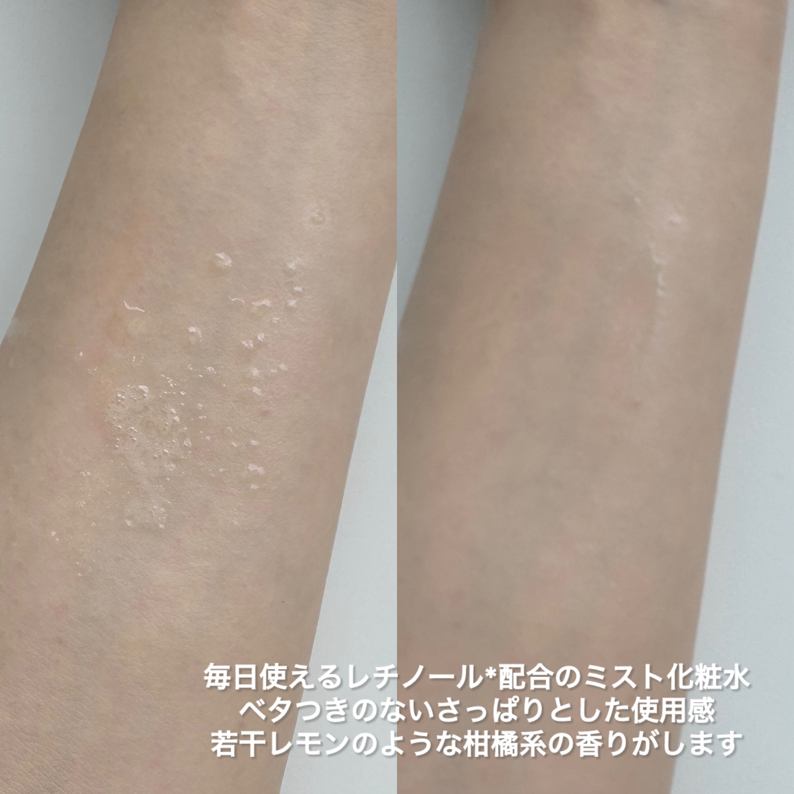 レチノールトナー/APLIN/ミスト状化粧水を使ったクチコミ（3枚目）