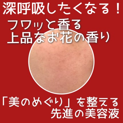 アルティミューン™ パワライジング コンセントレート Ⅲ/SHISEIDO/美容液を使ったクチコミ(4枚目)