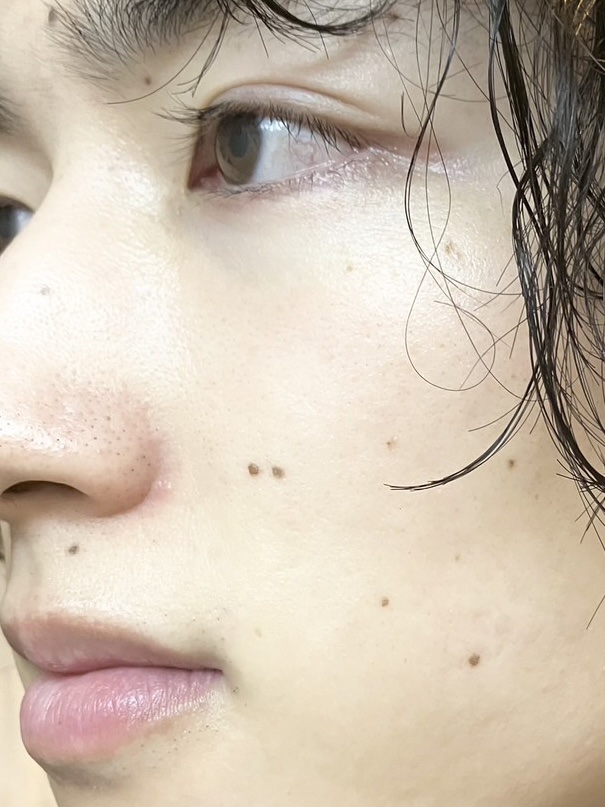 ガラクナイアシン2.0エッセンス/manyo/美容液を使ったクチコミ（2枚目）