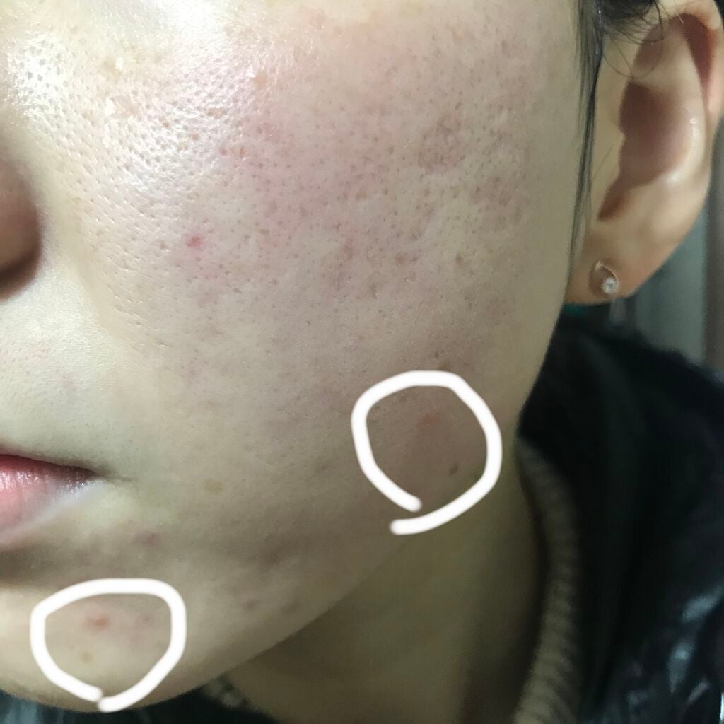 シルコット うるうるコットン/シルコット/コットンを使ったクチコミ(4枚目)