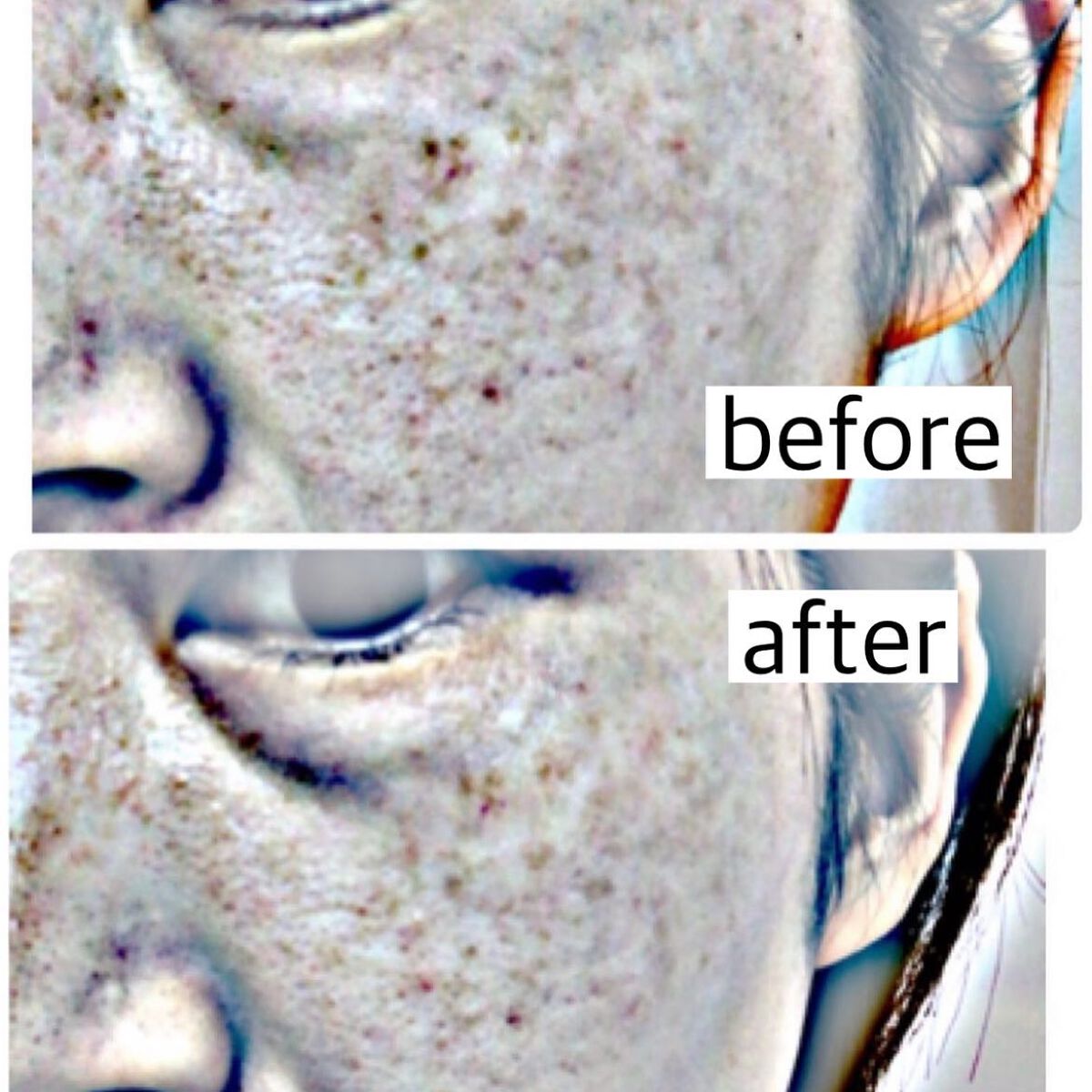 Ultra Whitening Perfect Ampoule/MIGUHARA/美容液を使ったクチコミ(2枚目)