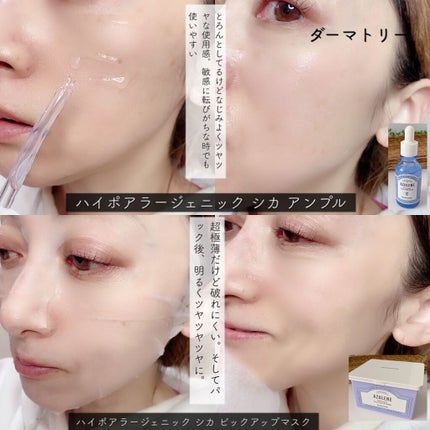 ハイポアレジェニックシカアンプル/Dermatory/美容液を使ったクチコミ(8枚目)