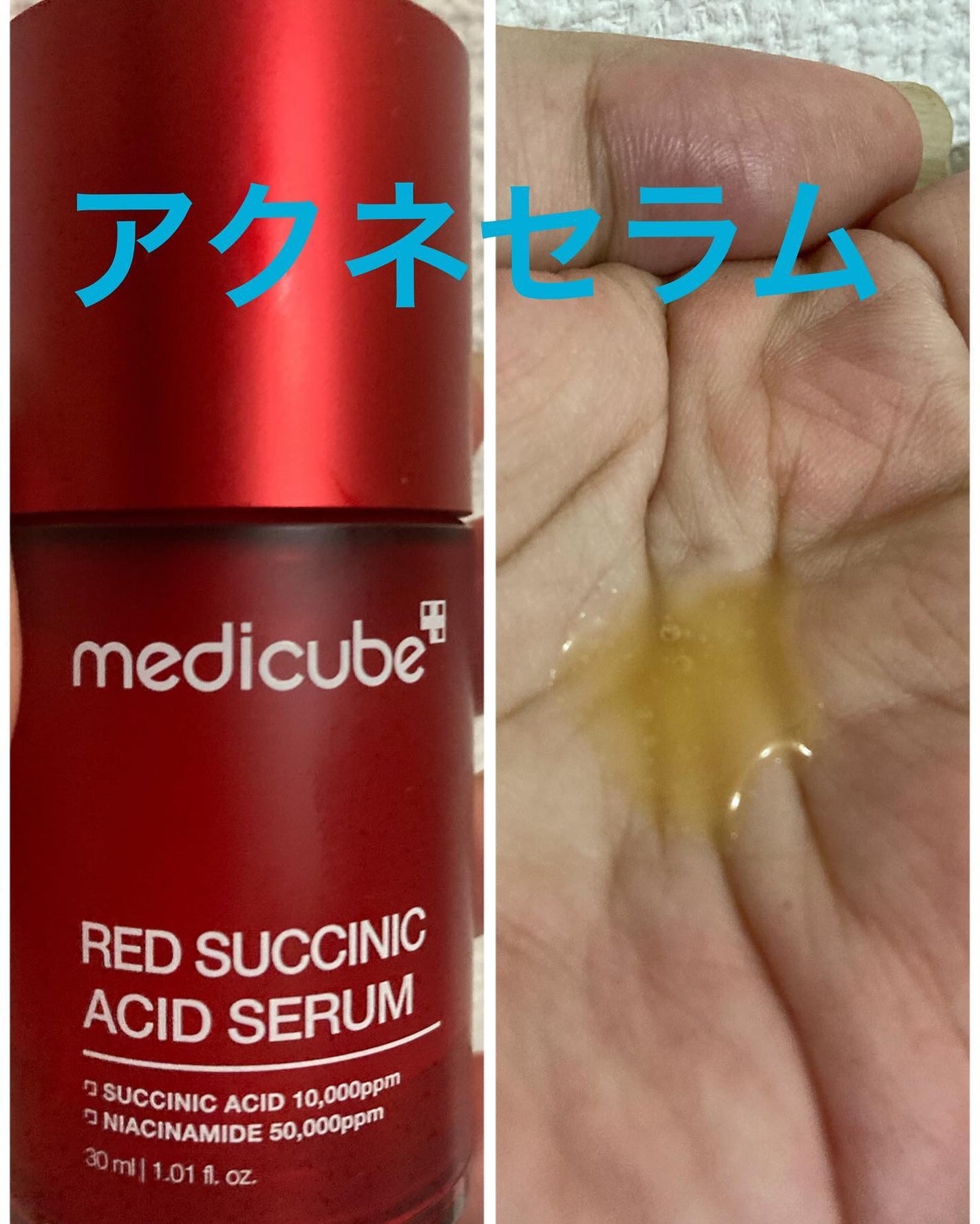 レッドアクネピーリングセラム/MEDICUBE/美容液を使ったクチコミ(4枚目)