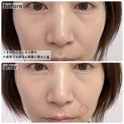 カバーアッププロコンシーラー/TFIT/パレットコンシーラーを使ったクチコミ(6枚目)