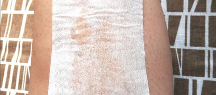 ベレーザブラジレイラ ブラックシュガーワックス/マニス/除毛クリームを使ったクチコミ(4枚目)