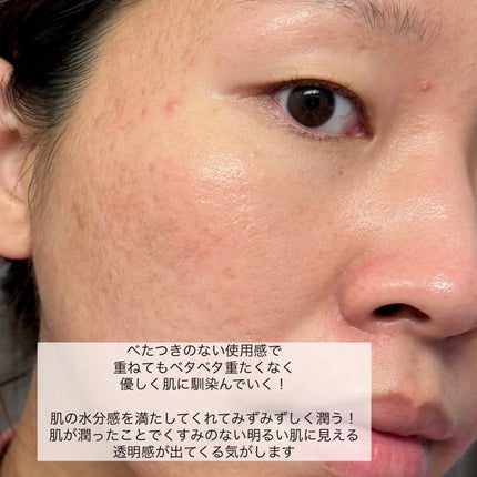 薬用雪肌精 ブライトニング エッセンス ローション/雪肌精/化粧水を使ったクチコミ(4枚目)