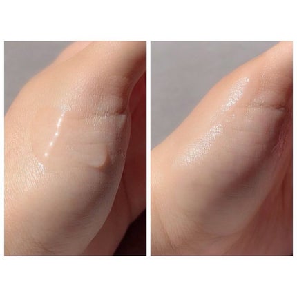 Dr.Arrivo ZeusII/ARTISTIC&CO./美顔器・マッサージを使ったクチコミ(5枚目)