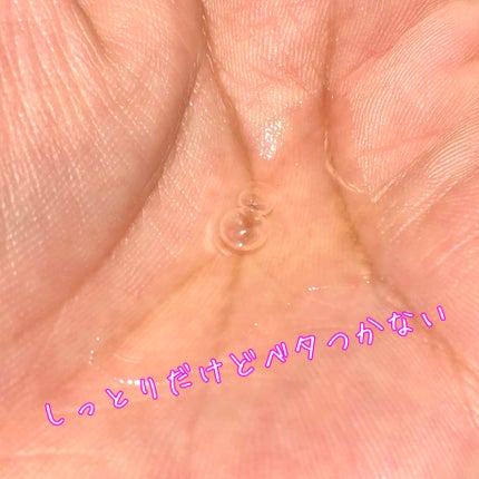 ナイアシンアミドブレミッシュケアセラム/ONE THING/美容液を使ったクチコミ(4枚目)