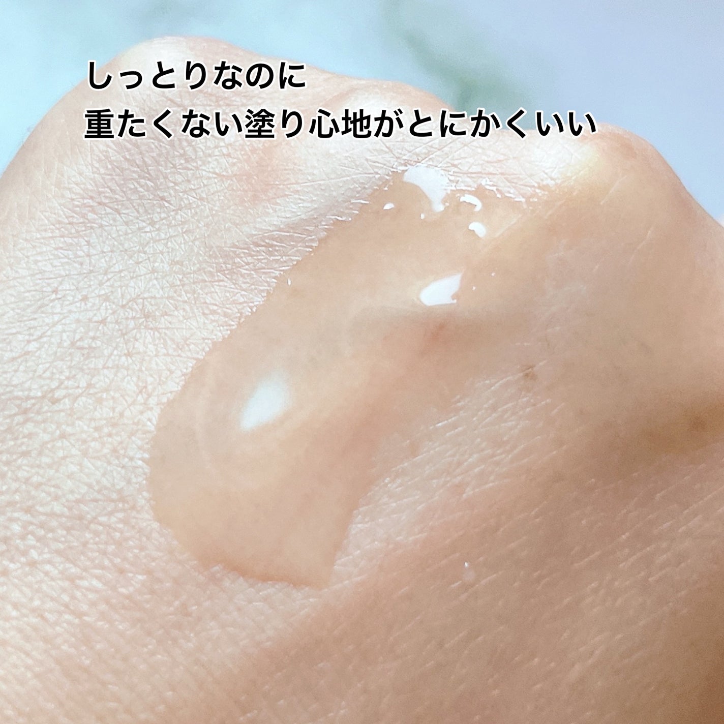 オイデルミン エッセンスローション/SHISEIDO/化粧水を使ったクチコミ(4枚目)