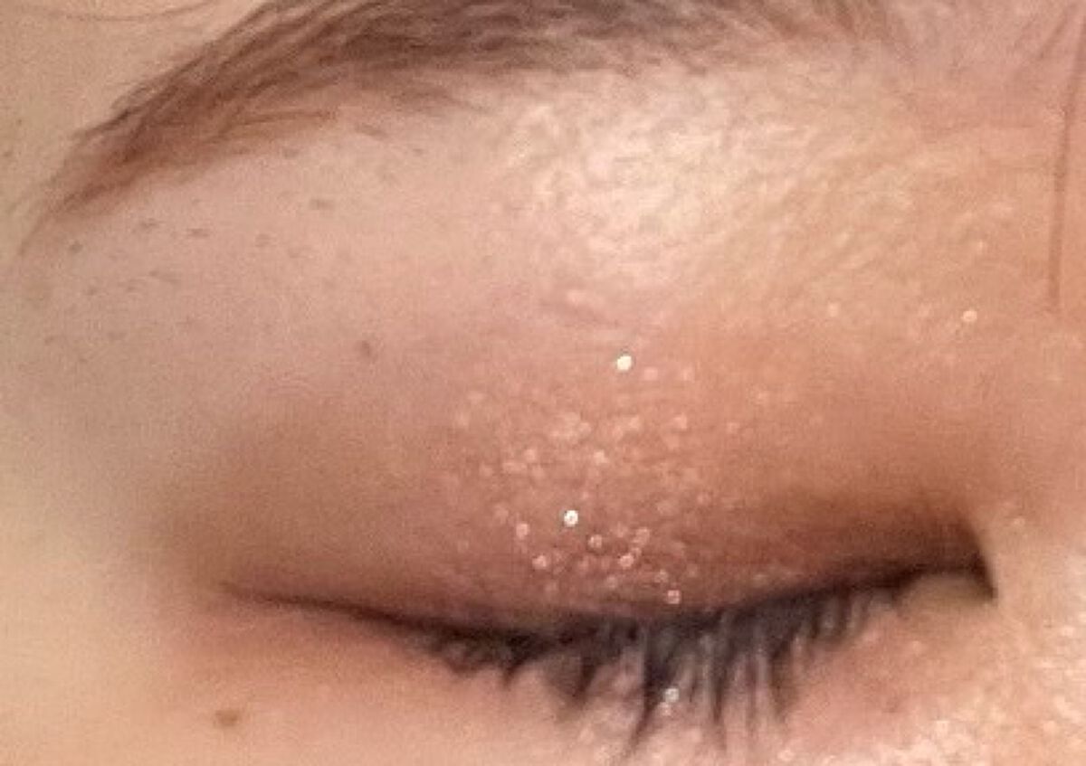 ダブル セラム バーム ファンデーション/Dr.Althea/クリーム・エマルジョンファンデーションを使ったクチコミ（2枚目）