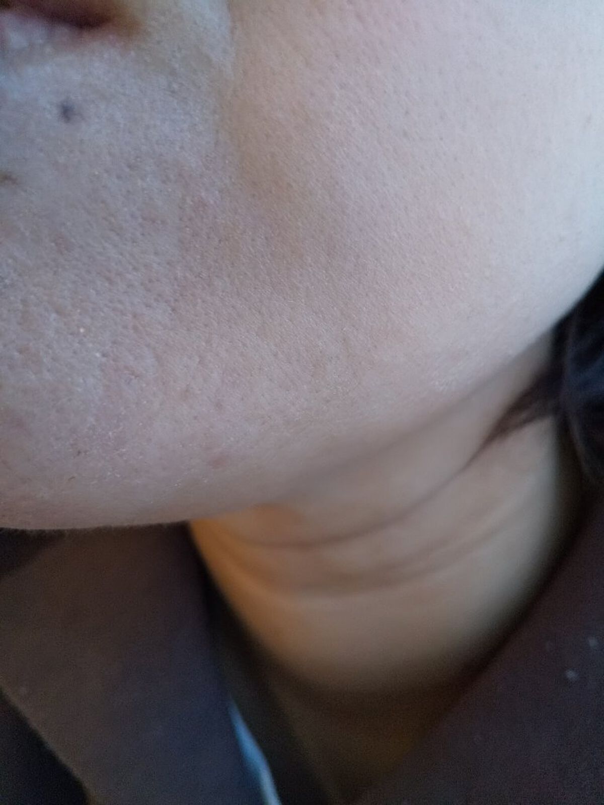 薬用しみ集中対策 プレミアム美容液/メラノCC/美容液を使ったクチコミ（3枚目）