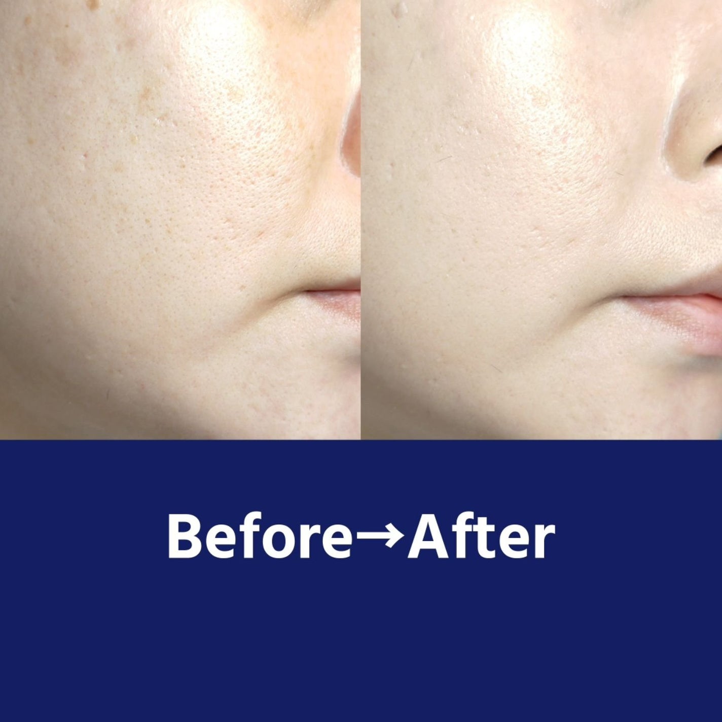 毛穴撫子 毛穴かくれんぼBBクリーム/毛穴撫子/BBクリームを使ったクチコミ(3枚目)