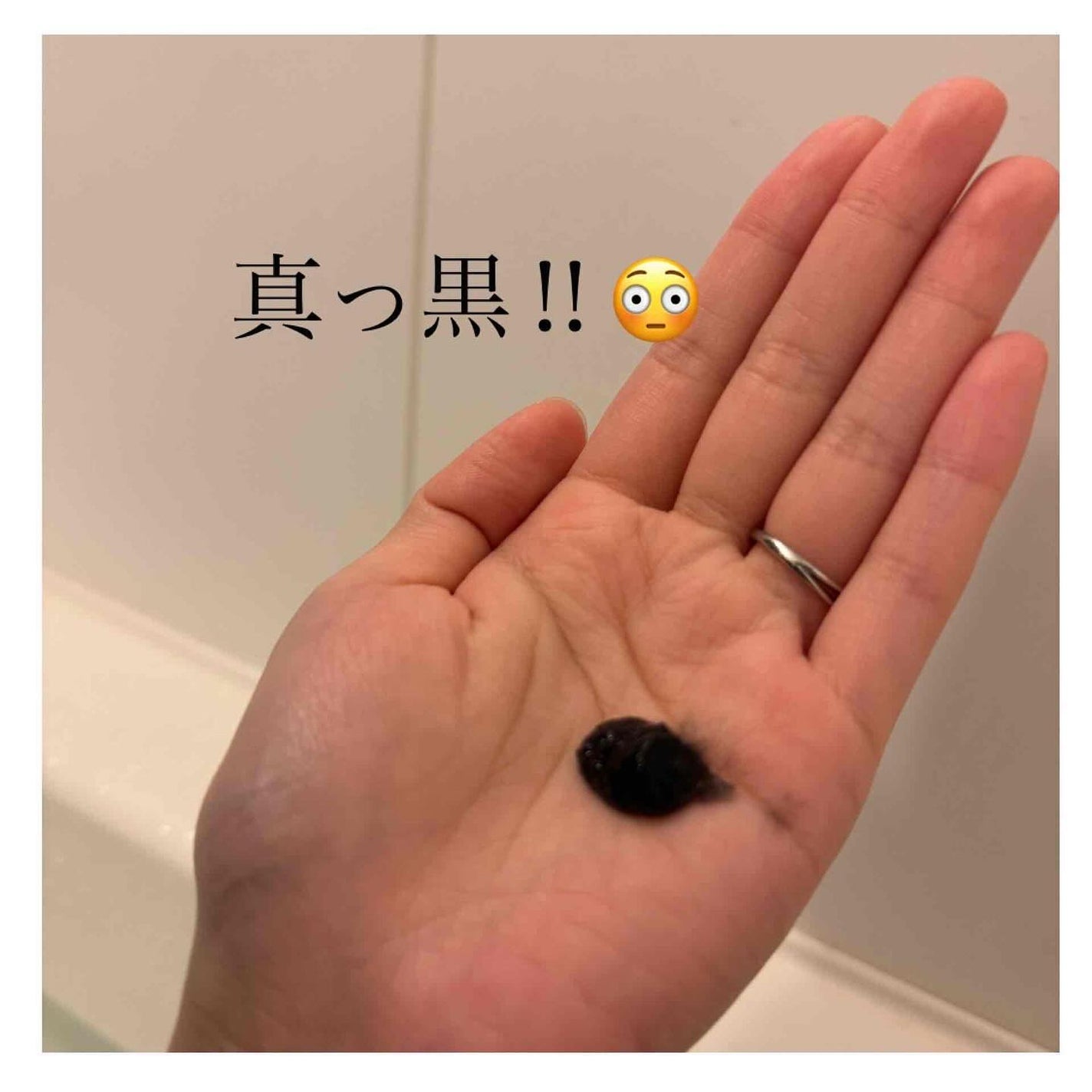 モイスチャースキンローション/VITAMIN PROD./化粧水を使ったクチコミ(5枚目)