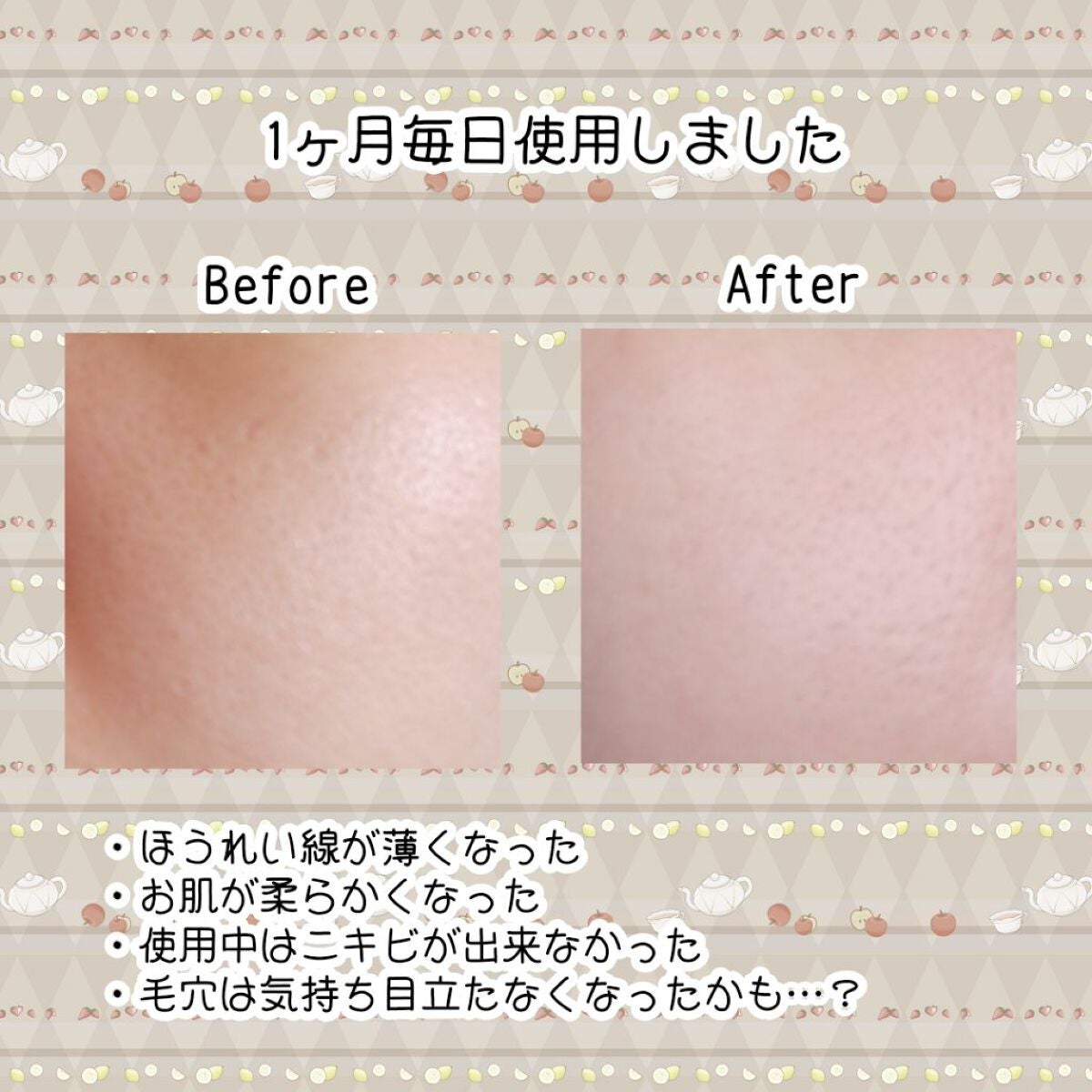 リードルショット300/VT/美容液を使ったクチコミ(4枚目)