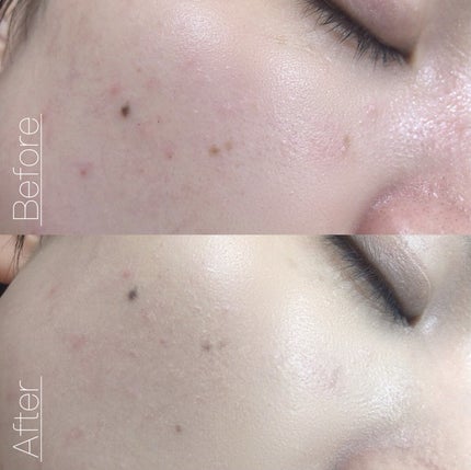 ピンクティーツリーカバークッション/APLIN/クッションファンデーションを使ったクチコミ(8枚目)