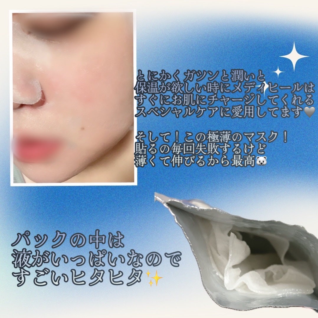 THE N.M.F APマスクJEX/MEDIHEAL/シートマスク・パックを使ったクチコミ(2枚目)