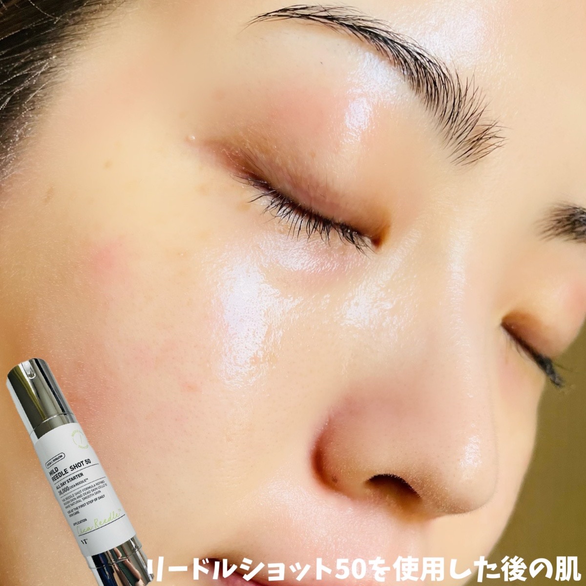 マイルドリードルショット50/VT/美容液を使ったクチコミ（3枚目）