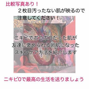 メンソレータム アクネス 薬用クリーム洗顔のクチコミ「二三枚目は私の写真なので注意です！
画像を保存するのは辞めてください🙇‍♀️🙇‍♀️🙇‍♀️
.....」（1枚目）