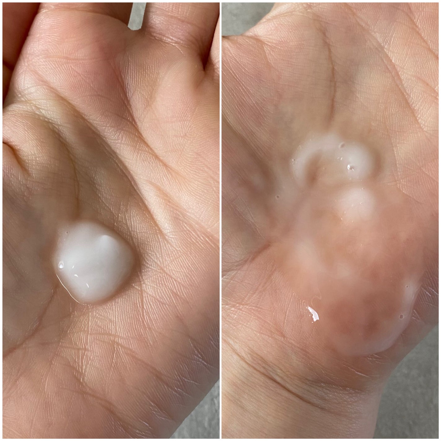 プロCICAリードルショット100/VT/ブースター・導入液を使ったクチコミ(3枚目)