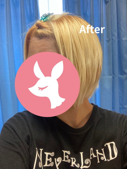 ブリーチ/フレッシュライト/ブリーチ剤を使ったクチコミ(4枚目)