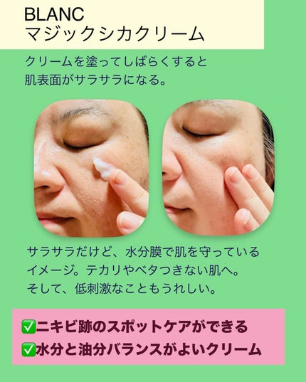 マジックシカクリーム/ブラン/フェイスクリームを使ったクチコミ(4枚目)