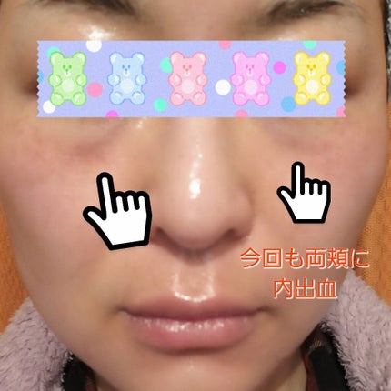 E.G.TタイムトックスAPマスクEX/MEDIHEAL/シートマスク・パックを使ったクチコミ(2枚目)