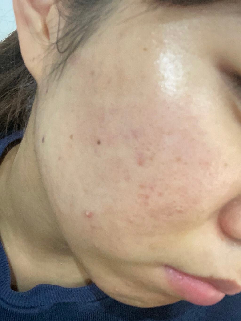 orange_blush_gxo on LIPS 「閲覧注意⚠️投稿サボりがちでした😵💫😵💫保湿クリーム変えて..」(1枚目)