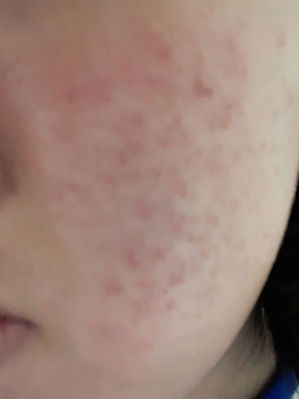 ハトムギ化粧水(ナチュリエ スキンコンディショナー R )/ナチュリエ/化粧水を使ったクチコミ（1枚目）