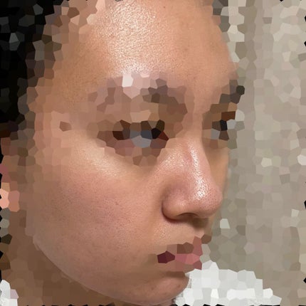 Vita-A Cream/Dr.Different/フェイスクリームを使ったクチコミ(9枚目)