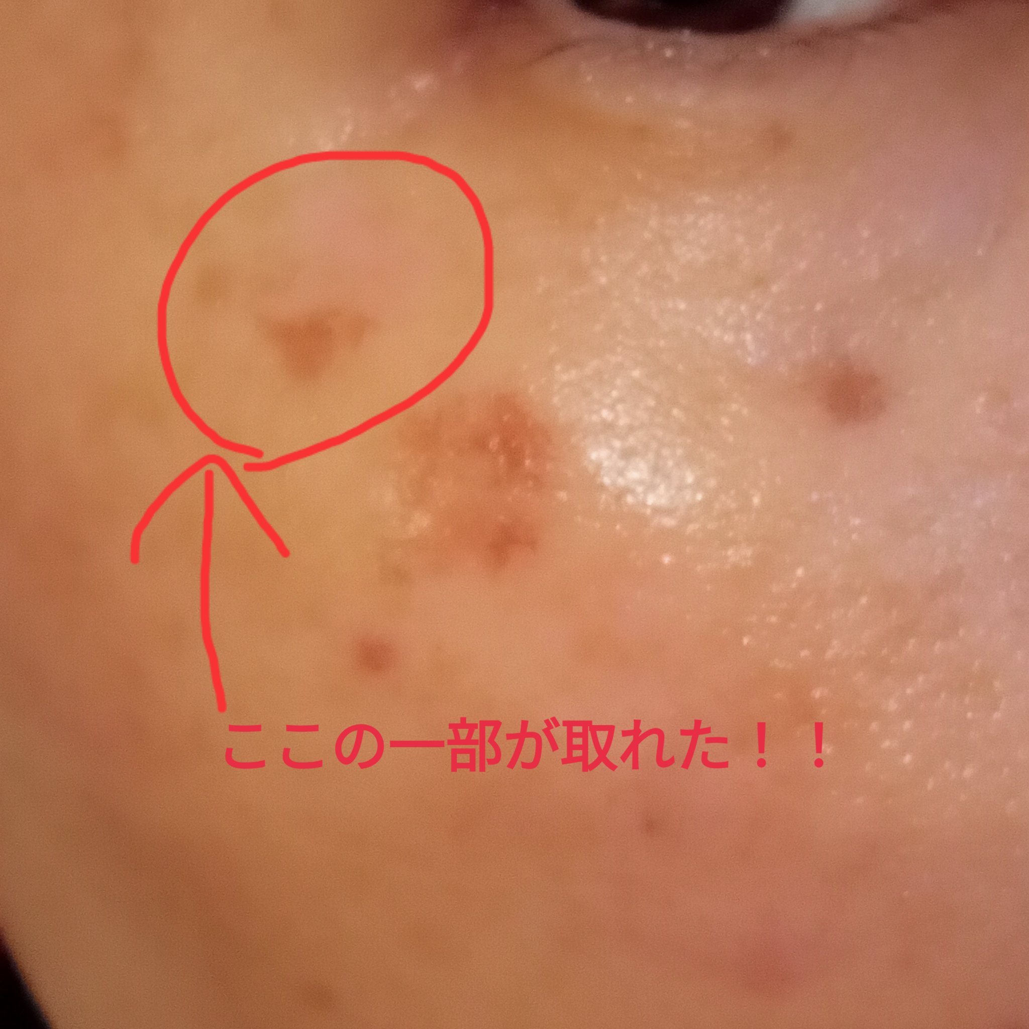 を使ったクチコミ（2枚目）