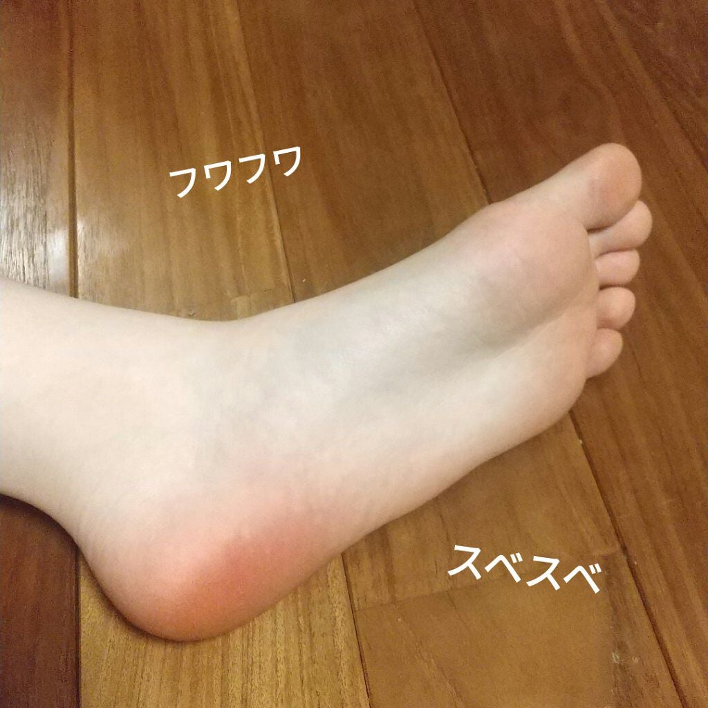 ダイエットスリッパ(BK)/ニトリ/ボディグッズを使ったクチコミ(4枚目)