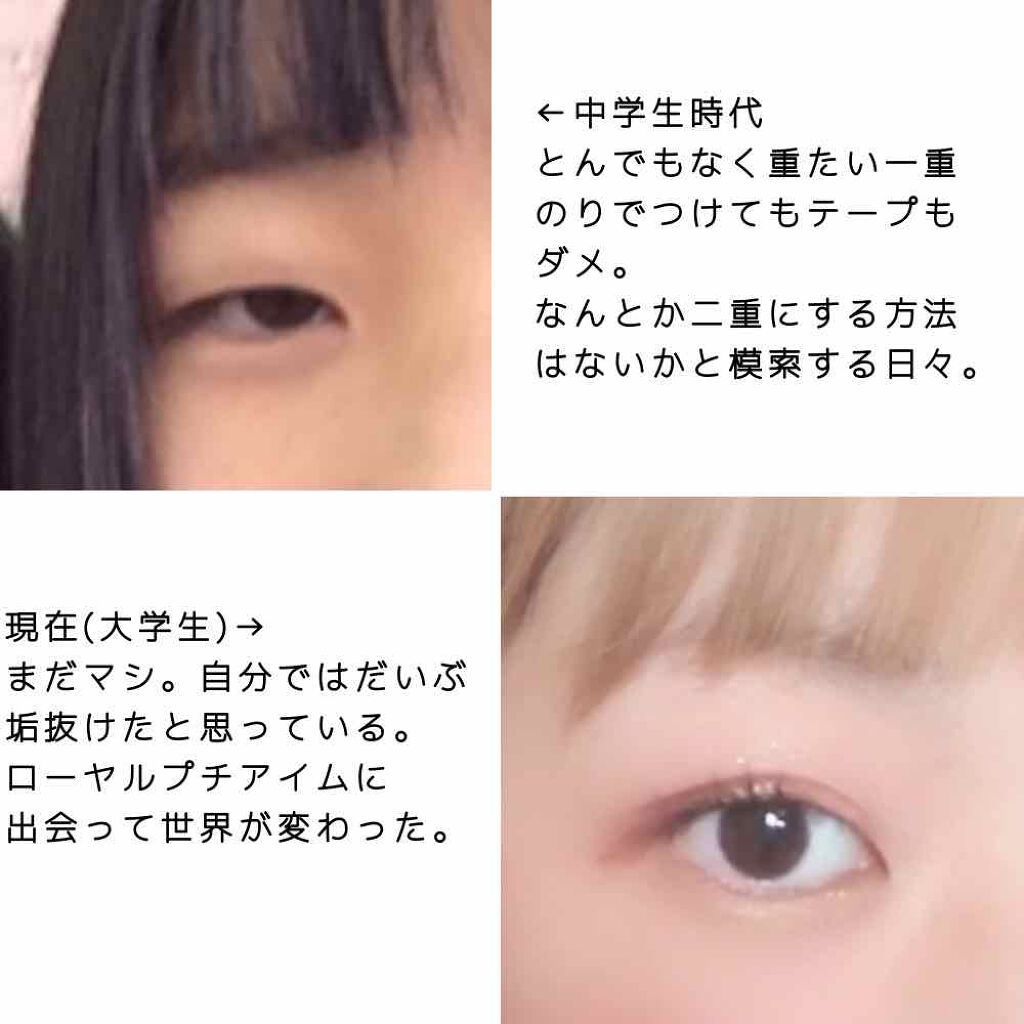 ひとえ・奥ぶたえ用カーラー/アイプチ®/ビューラーを使ったクチコミ（2枚目）