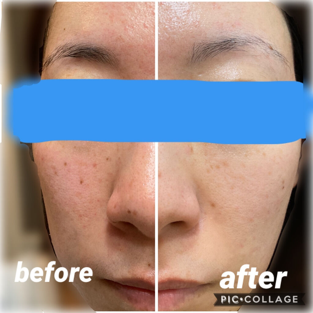 クレンジング フレッシュフォームe/IPSA/洗顔フォームを使ったクチコミ（3枚目）