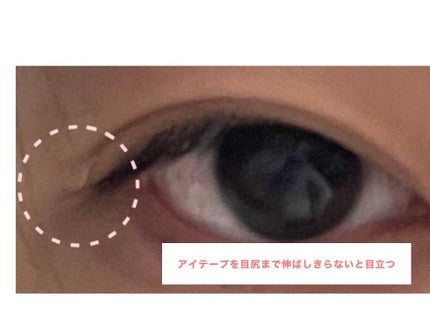 のびーるアイテープ(絆創膏タイプ、レギュラー)/DAISO/二重まぶた用アイテムを使ったクチコミ(5枚目)