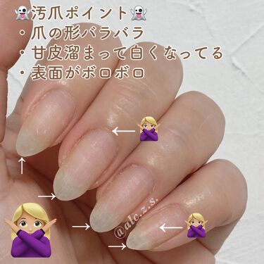 ネイルファイル ビューティーワールドを使った口コミ 久しぶりにジェルをオフしたら自爪がえらいこ By Alice Slowly 普通肌 Lips