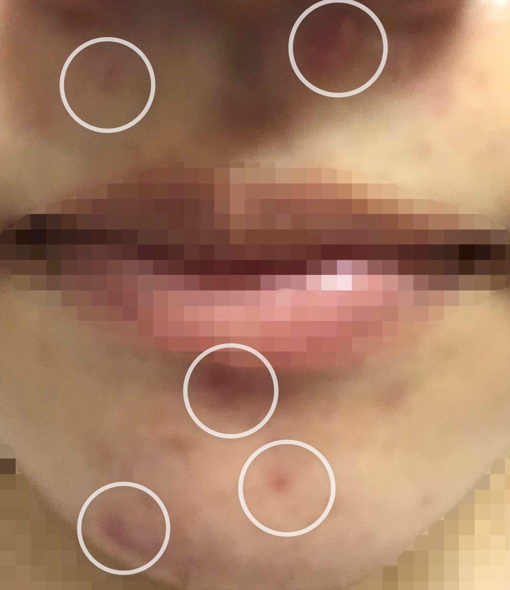 を使ったクチコミ（3枚目）