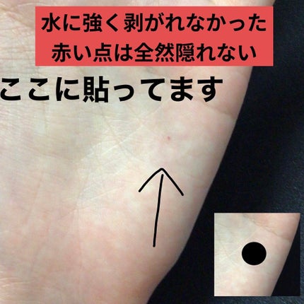極薄透明パッチ nikipa!/金冠堂/にきびパッチを使ったクチコミ(3枚目)