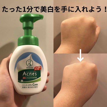 薬用ふわふわな泡洗顔/メンソレータム アクネス/泡洗顔を使ったクチコミ(1枚目)