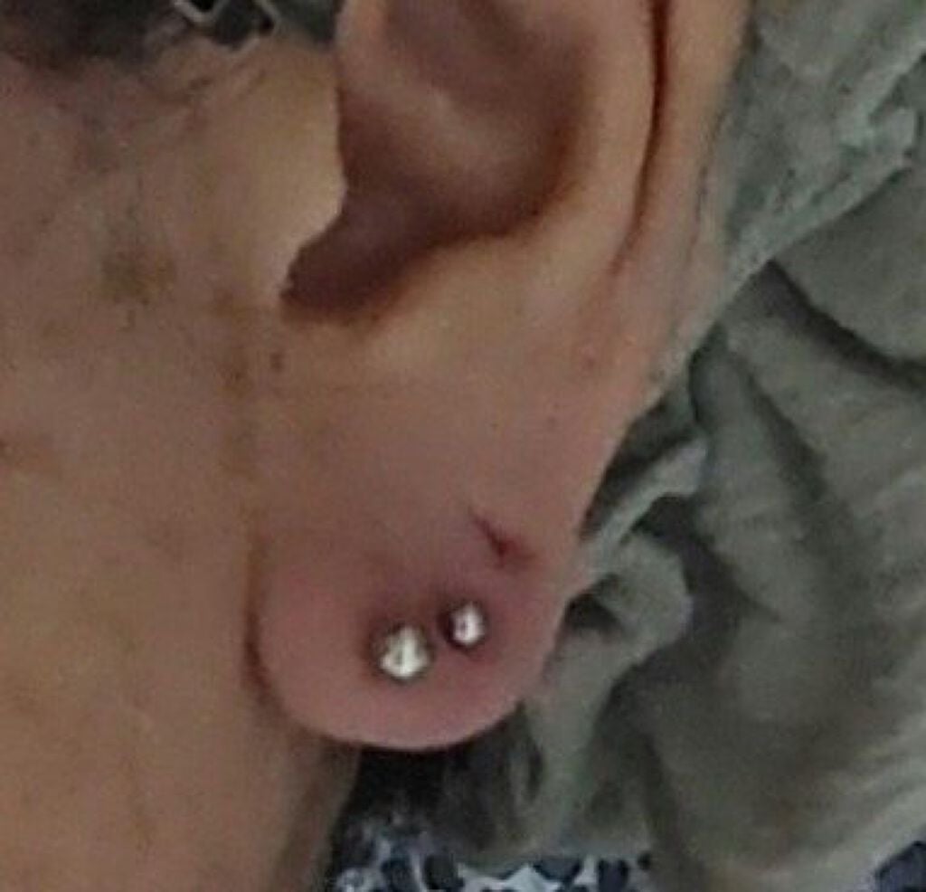 キュアレア(医薬品)/キュアレアa/その他を使ったクチコミ(1枚目)