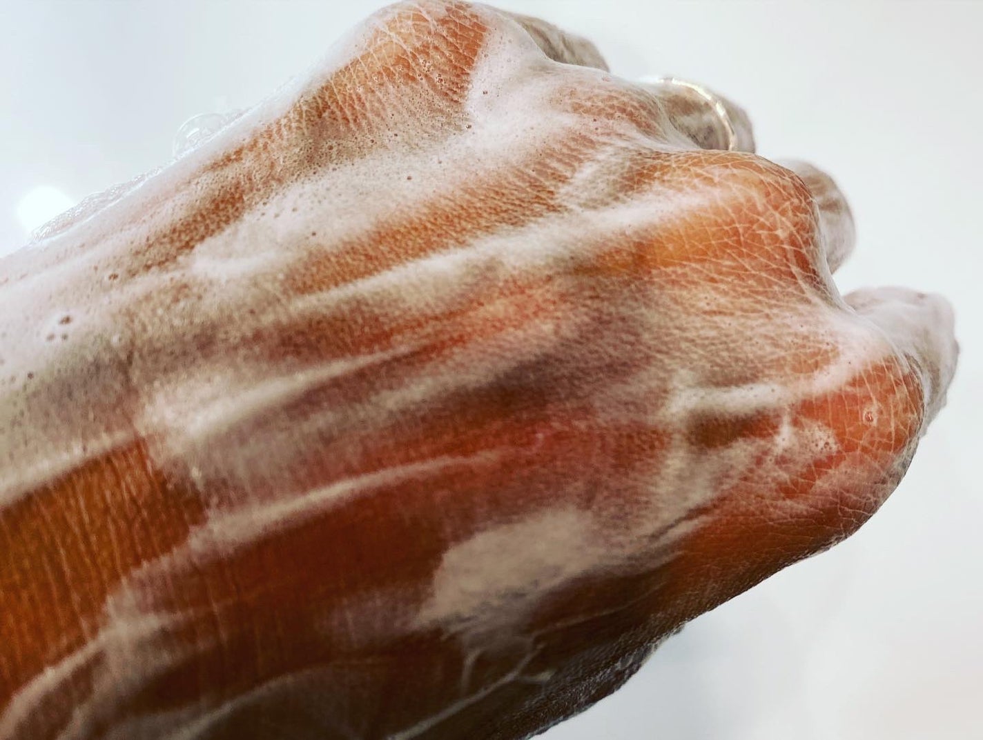 lovebeer on LIPS 「私が通う皮膚科帰りの調剤薬局に、必ず置いてあるのがNOVシリー..」(7枚目)