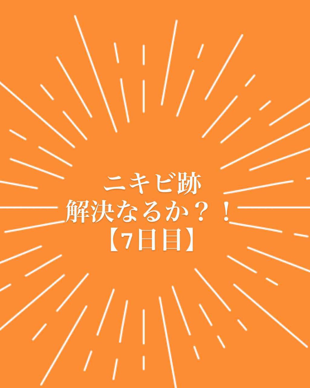 AHA·BHA·PHA 30デイズミラクルトナー/SOME BY MI/化粧水を使ったクチコミ（1枚目）