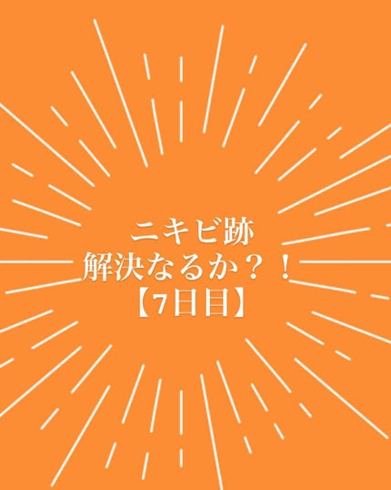 AHA·BHA·PHA 30デイズミラクルトナー/SOME BY MI/化粧水を使ったクチコミ(1枚目)