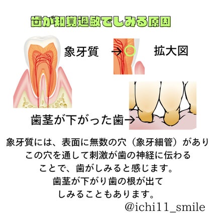 ガム・知覚過敏ラボ デンタルペースト/GUM/歯磨き粉を使ったクチコミ(2枚目)